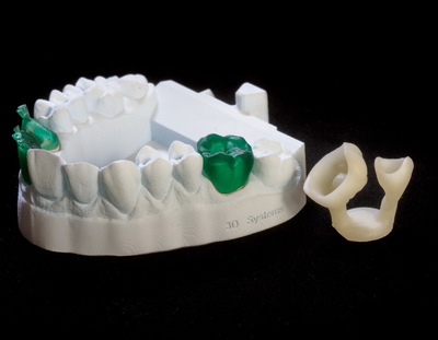 ProJet_1200_model_and_waxups.jpg ProJet_1200_model_and_waxups.jpg